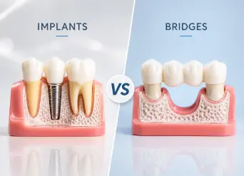 Helpful dental information about dental implants Moreno Valley